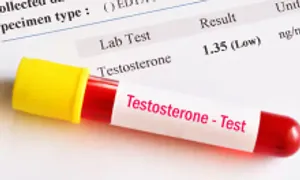 Dấu hiệu ngoài da cảnh báo giảm testosterone Dấu hiệu ngoài da cảnh báo giảm testosterone