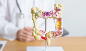 Bác sĩ Anh cảnh báo kiểu ăn khiến nhiều người trẻ ung thư Bác sĩ Anh cảnh báo kiểu ăn khiến nhiều người trẻ ung thư