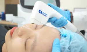 Các phương pháp cải thiện rãnh cười Các phương pháp cải thiện rãnh cười