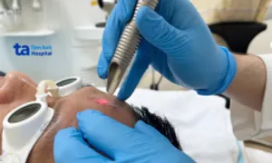 Xóa vết sẹo giữa trán người đàn ông Xóa vết sẹo giữa trán người đàn ông