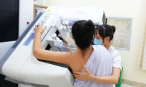 Nhũ hoa chảy máu có phải dấu hiệu ung thư? Nhũ hoa chảy máu có phải dấu hiệu ung thư?