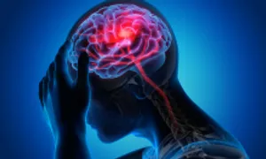 Xin về khi đang điều trị, cụ ông bị di chứng nhồi máu não nặng Xin về khi đang điều trị, cụ ông bị di chứng nhồi máu não nặng