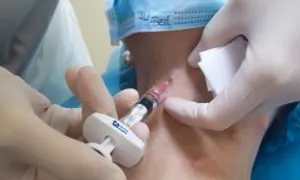 Làm thế nào xóa nếp nhăn ở cổ? Làm thế nào xóa nếp nhăn ở cổ?
